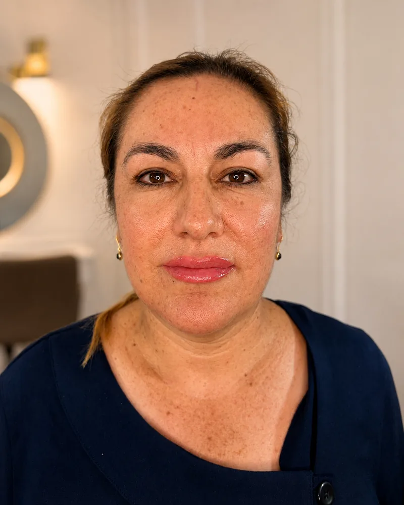 Resultado final de micropigmentación de labios